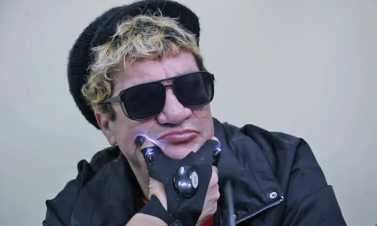 Internaron a “Pity” Álvarez en el Hospital Tornú tras el choque en la estación de servicio