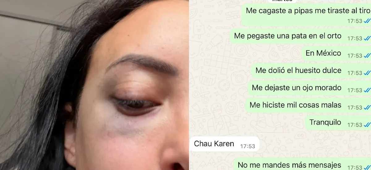 La novia de un ex futbolista de Boca lo acusó por violencia de género