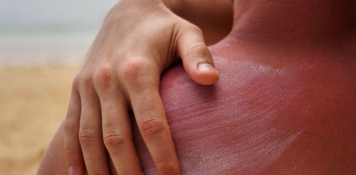 Cómo estará el índice de rayos UV hoy 28 de febrero