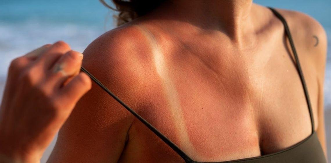 Cómo estará el índice de rayos UV hoy, domingo 1 de marzo