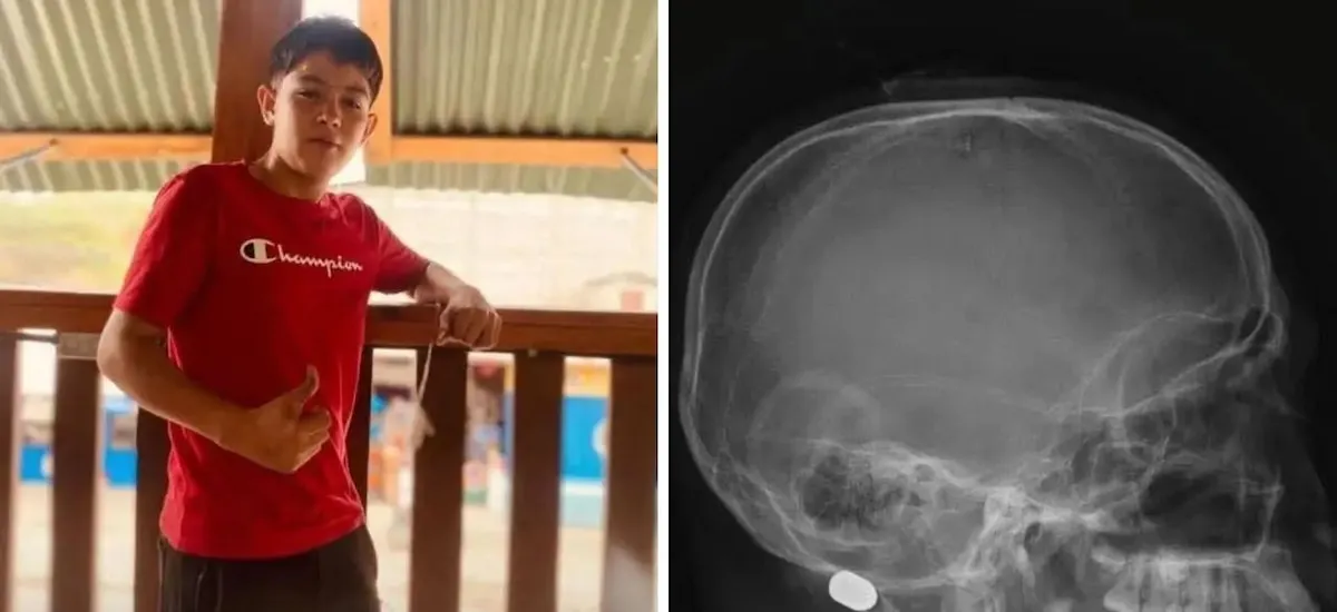Muere adolescente de 14 años tras ser alcanzado por una presunta bala perdida en Honduras
