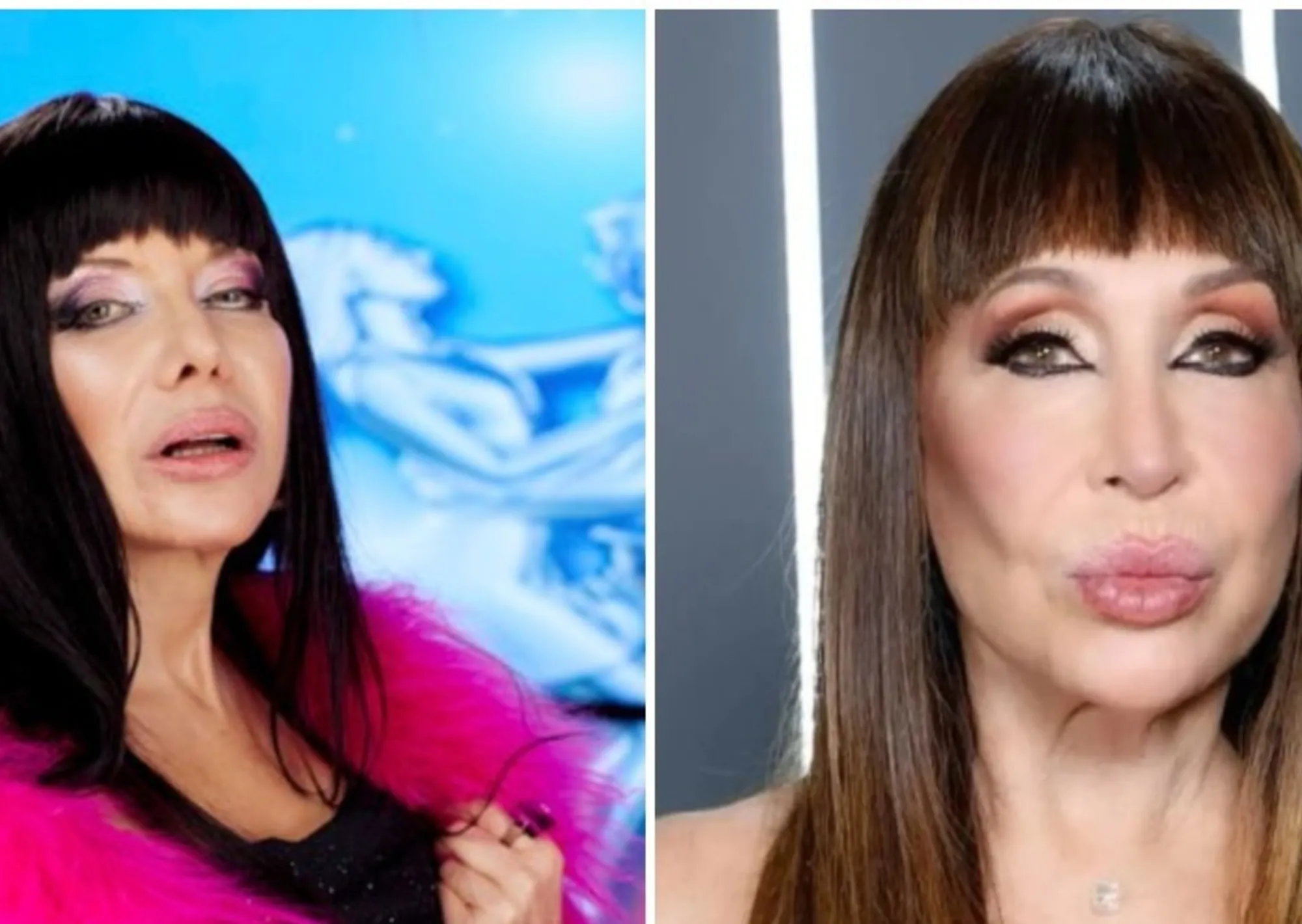 Cecilia Roth reveló el accidente doméstico que sufrió durante el rodaje de la serie de Moria Casán: “Me dieron nueve puntos”