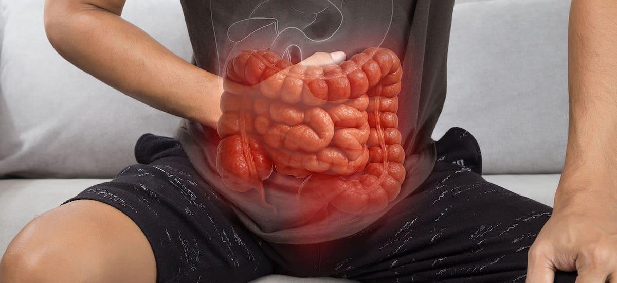 Salud intestinal: estos 6 alimentos dañan tu estado de ánimo todos los días y deberías evitarlos