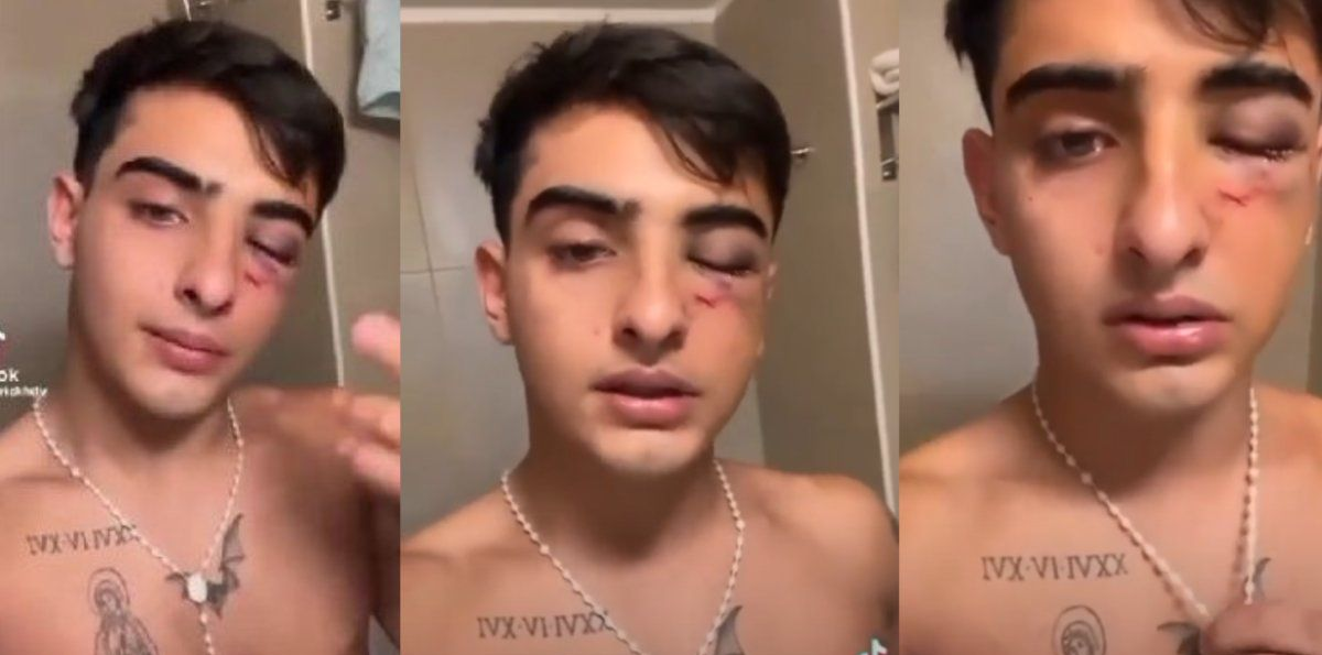 Brutal golpiza en Tucumán: un grupo de rugbiers atacó a un joven y lo dejó inconsciente en una zanja