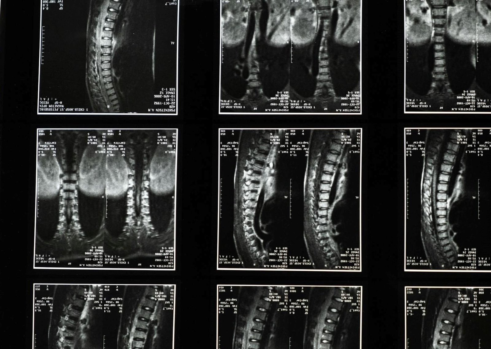 Jose Manuel Felices, doctor: “El dolor de cadera duele y frena. Hay que hacer un ejercicio específico”