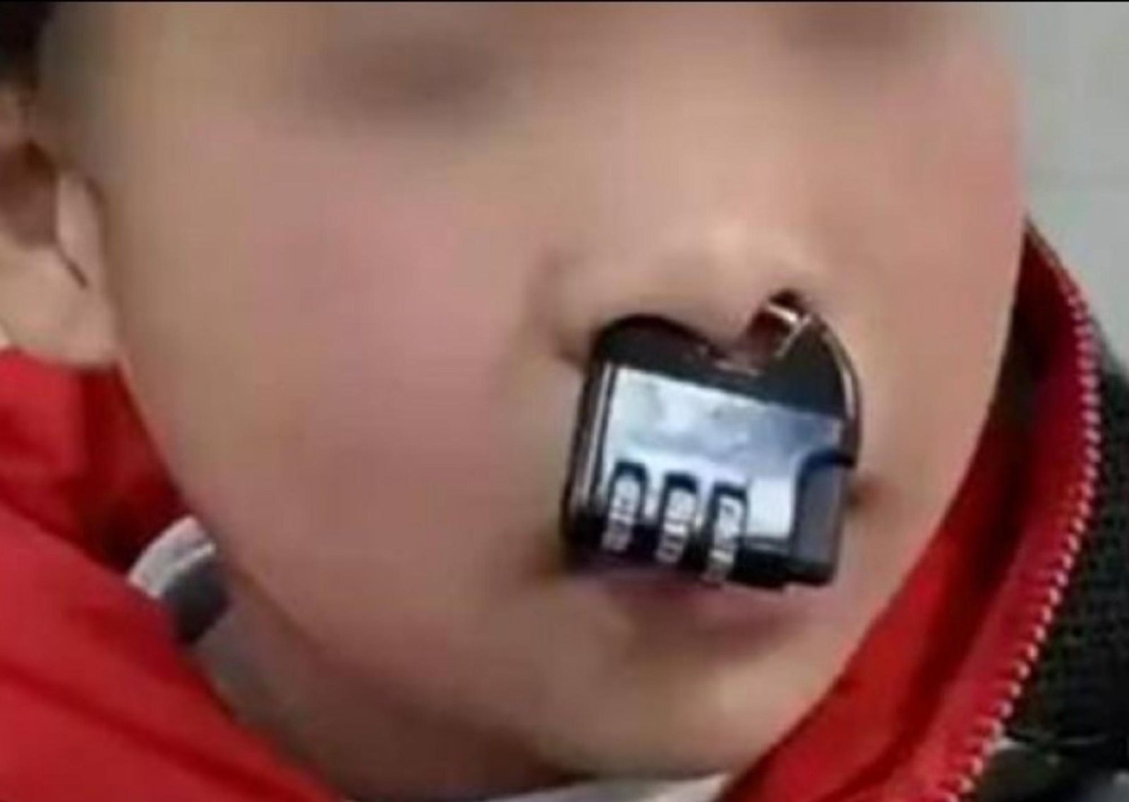 Un nene se quedó con un candado atascado en su nariz por no saber la combinación