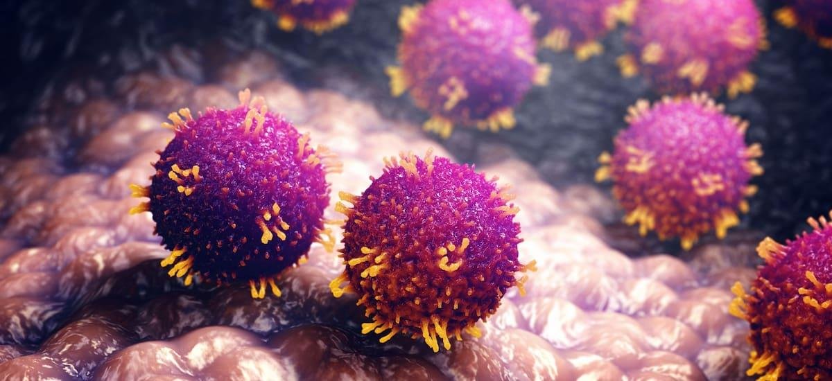 Alerta sanitaria en el continente | Advierten rebrote de una enfermedad histórica: ya son más de 7,000 infectados y hay decenas de muertos