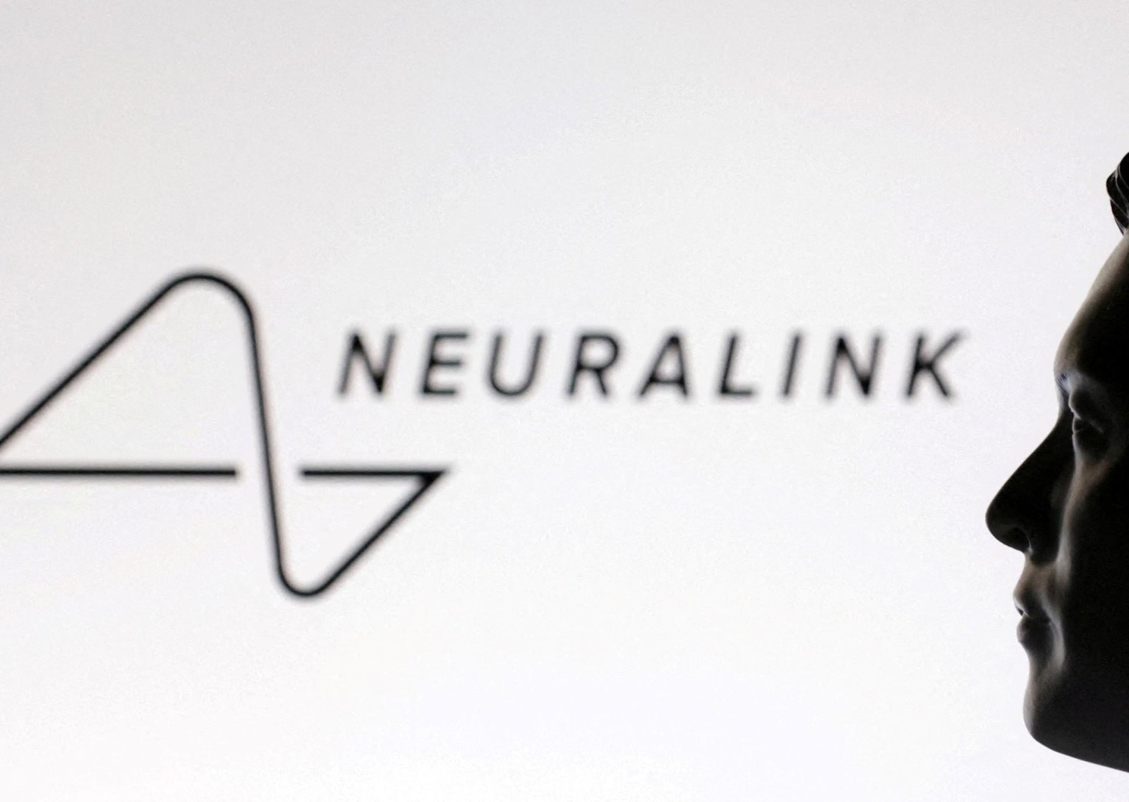 Quedó parapléjico tras un accidente y ahora prueba el chip cerebral de Elon Musk: “Se siente mágico”