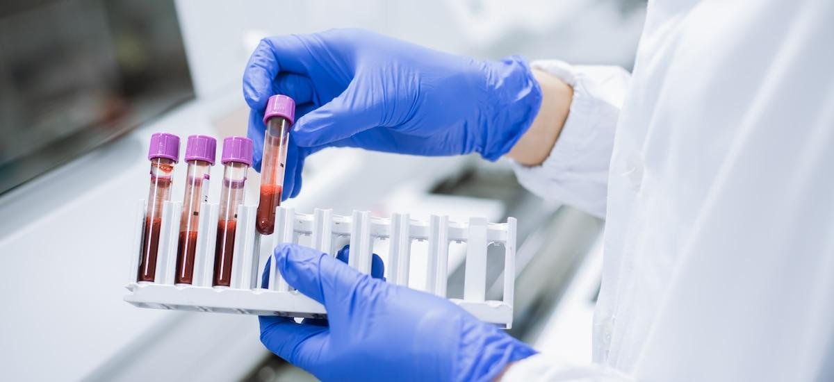 ¿Cuál es el factor sanguíneo que trajeron los españoles a América?